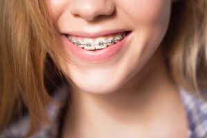 Guide to Orthodontists in the OKC Metro